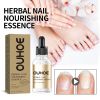 OUHOE Herbal Nail Nourishing Essence, Hand And Foot Moisturizing Care And Thickening Nail Grey Nail Inlaid Nail Shine Essential Oil